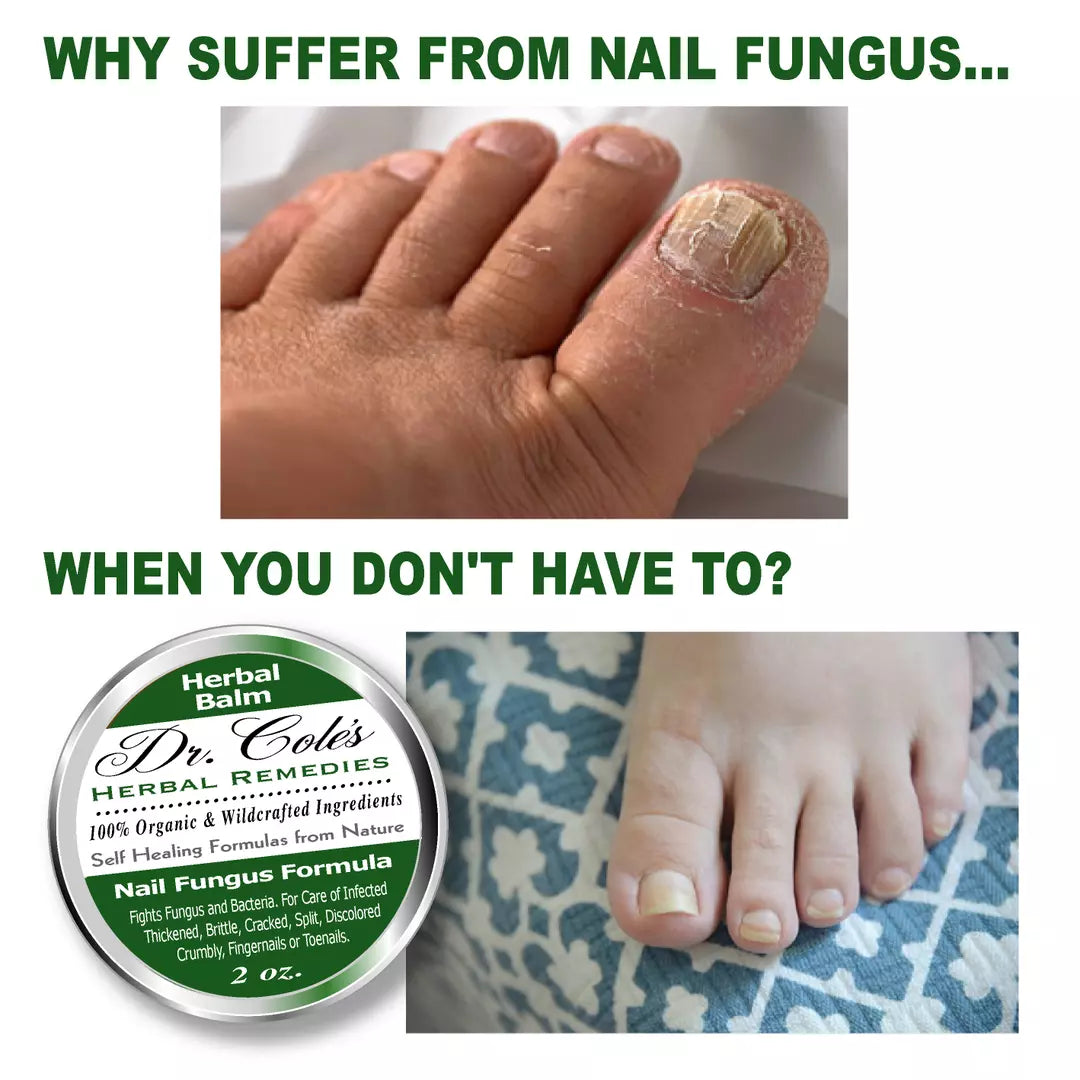 12 - Dr. Cole's Nail Fungus Balm