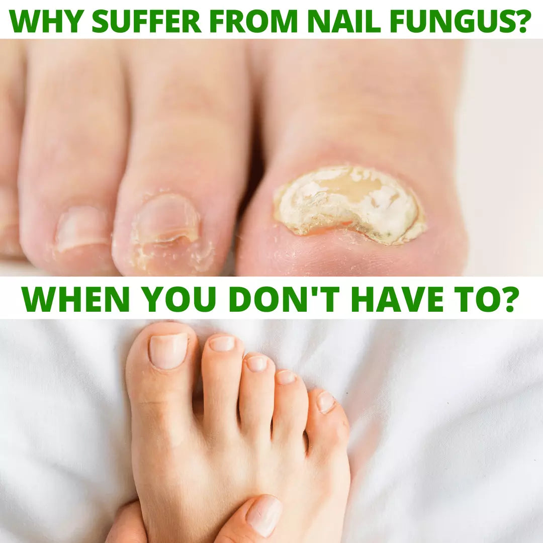 12 - Dr. Cole's Nail Fungus Balm